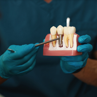 Dental Implants & Cosmetic Dentistry